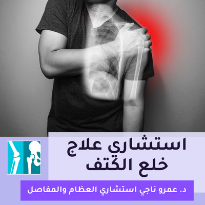 أفضل دكتور لعلاج خلع الكتف في مصر