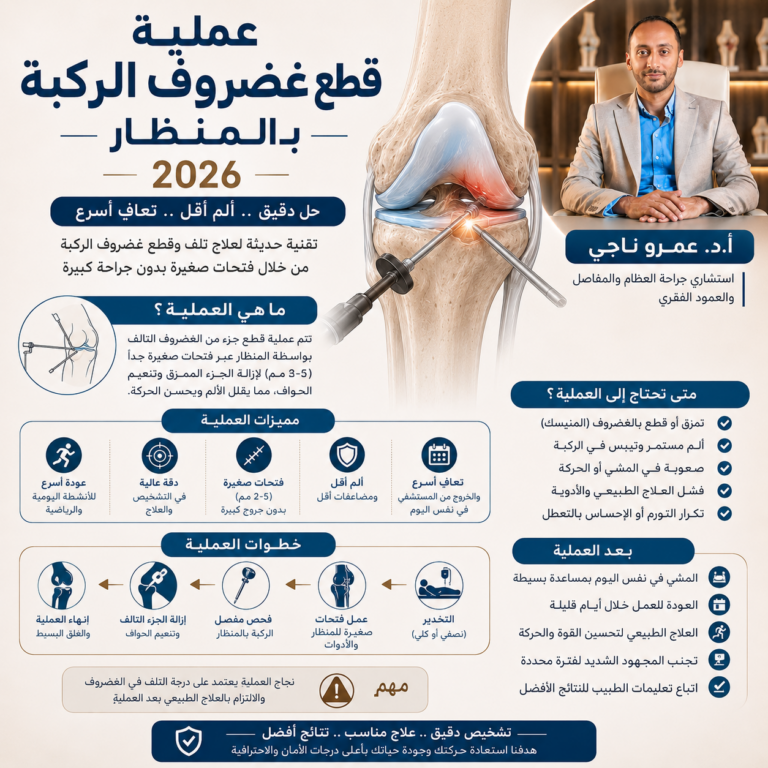 عملية قطع غضروف الركبة بالمنظار 2026