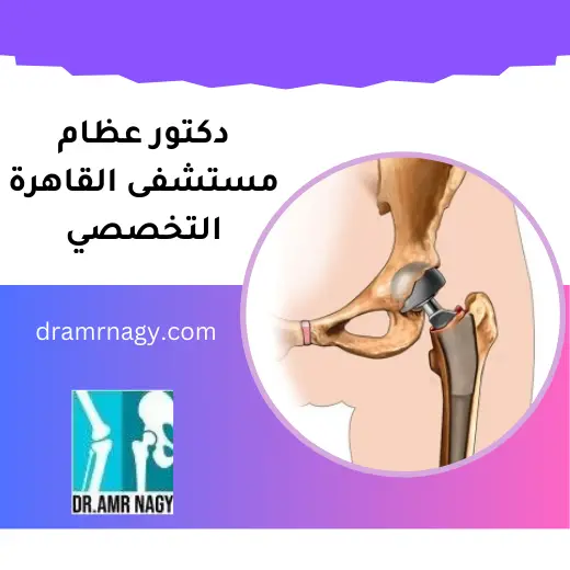 دكتور عظام مستشفى القاهرة التخصصي