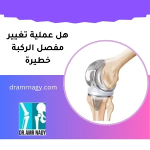 هل عملية تغيير مفصل الركبة خطيرة