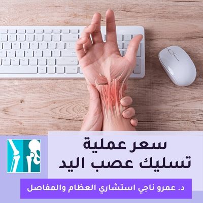 سعر عملية تسليك عصب اليد