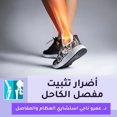 أضرار تثبيت مفصل الكاحل