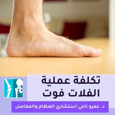 تكلفة عملية الفلات فوت في مصر