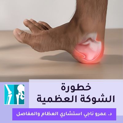 خطورة الشوكة العظمية