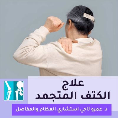 علاج الكتف المتجمد