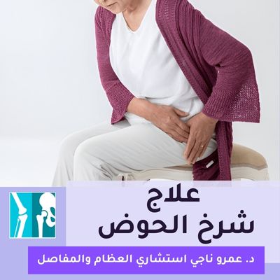 علاج شرخ الحوض البسيط