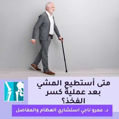 متى أستطيع المشي بعد عملية كسر الفخذ