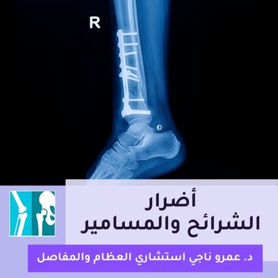 أضرار الشرائح والمسامير