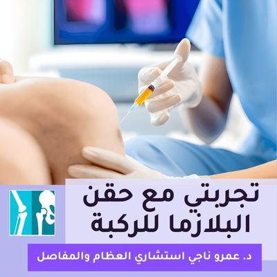 تجربتي مع حقن البلازما للركبة