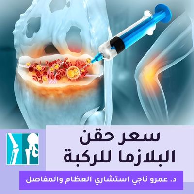 سعر حقن البلازما للركبة