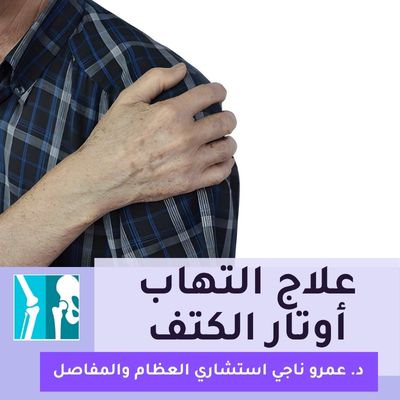 علاج التهاب أوتار الكتف