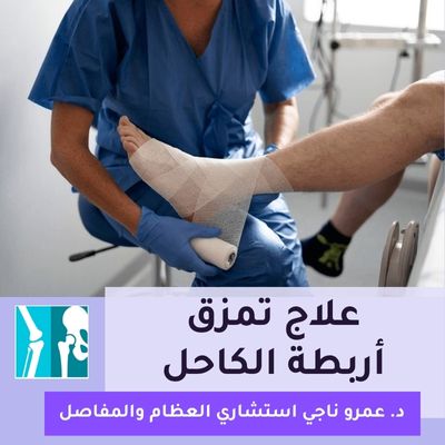 علاج تمزق أربطة الكاحل