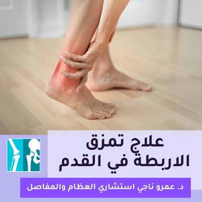 علاج تمزق الاربطة في القدم