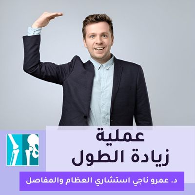عملية زيادة الطول