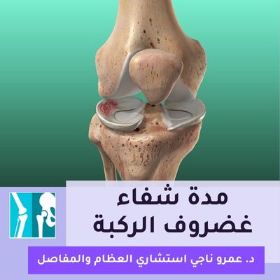 مدة شفاء غضروف الركبة