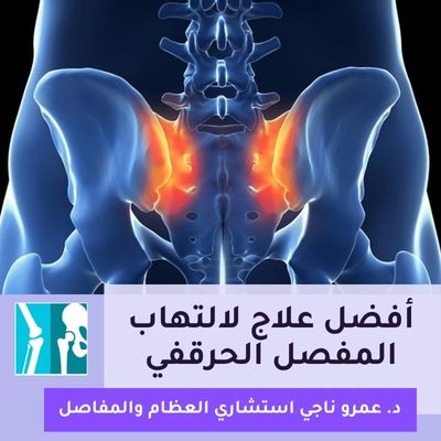 أفضل علاج لالتهاب المفصل الحرقفي