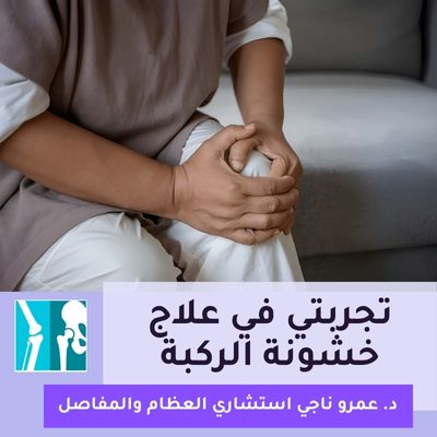 تجربتي في علاج خشونة الركبة