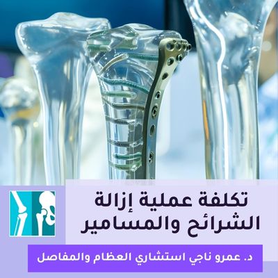 كم تكلفة عملية إزالة الشرائح والمسامير