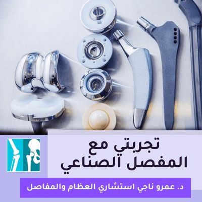 تجربتي مع المفصل الصناعي