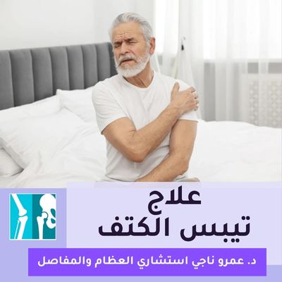 علاج تيبس الكتف