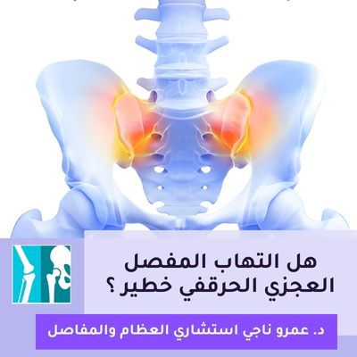 هل التهاب المفصل العجزي الحرقفي خطير