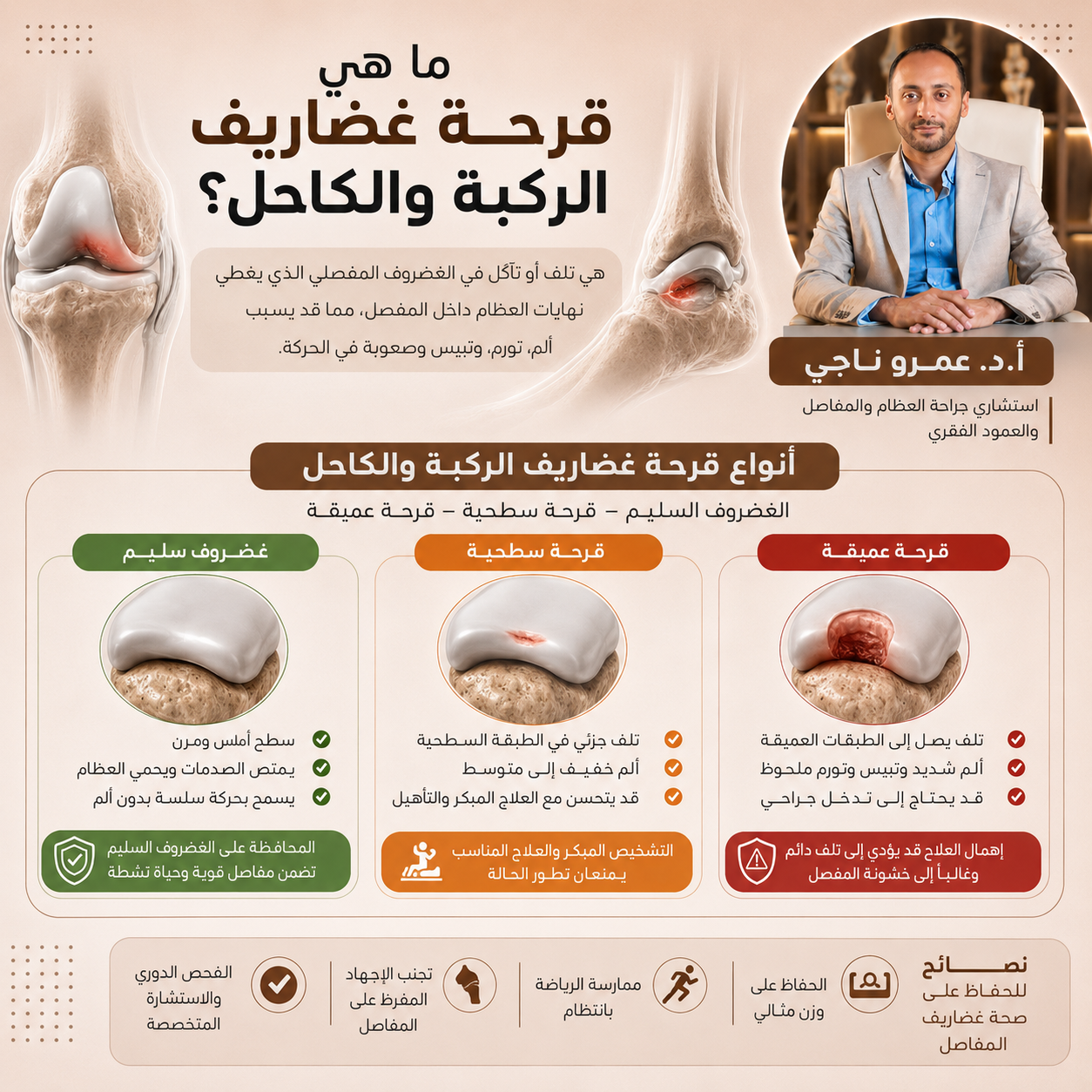 أنواع قرحة غضاريف الركبة والكاحل: غضروف سليم وقرحة سطحية وقرحة عميقة — أ.د. عمرو ناجي