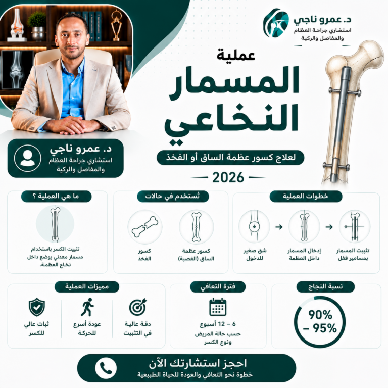 عملية المسمار النخاعي