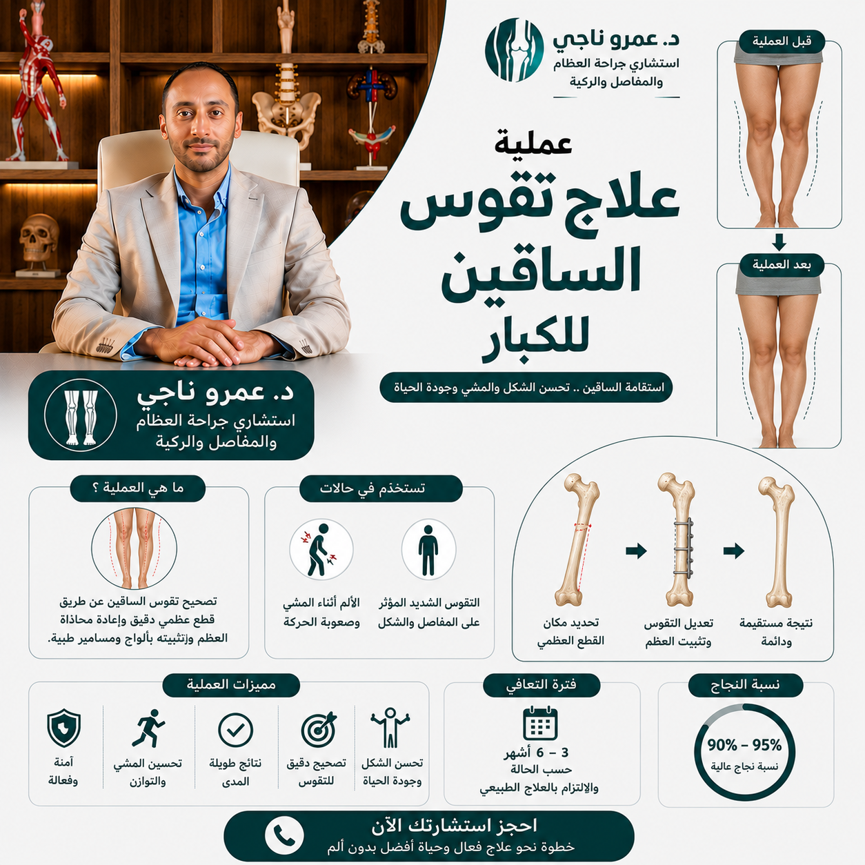 استعدال تقوس الساقين جراحياً عند الكبار - أ.د. عمرو ناجي