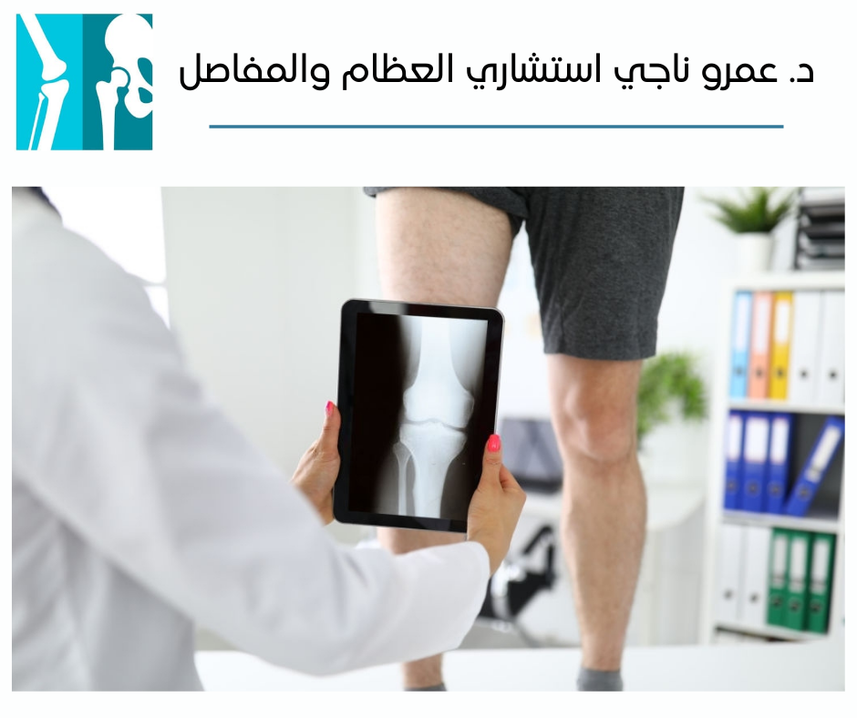 علاج قطع الرباط الصليبي الأمامي بدون جراحة — د. عمرو ناجي